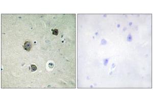 Immunohistochemistry analysis of paraffin-embedded human brain tissue using CDK5 (epitope around residue 15) antibody.