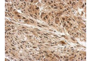 Immunohistochemistry (IHC) image for anti-Damage Specific DNA Binding Protein 1 (DDB1) (C-Term) antibody (ABIN2854664)