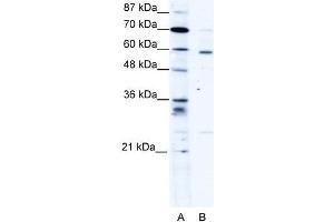 Human HepG2; WB Suggested Anti-PDLIM5 Antibody Titration: 1. (PDLIM5 antibody  (Middle Region))