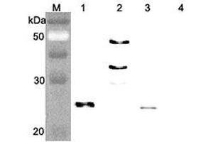 Western blot analysis of human FGF21 using anti-FGF-21 (human), pAb  at 1:4,000 dilution. (FGF21 antibody)