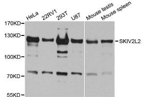 Western blot analysis of extracts of various cell lines, using SKIV2L2 antibody. (MTR4 antibody  (AA 1-304))