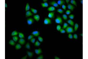 Immunofluorescence staining of Hela cells with ABIN7147649 at 1:100, counter-stained with DAPI. (CHODL antibody  (AA 105-206))