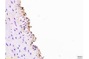 Formalin-fixed and paraffin embedded rabbit carotid artery labeled Anti-Cyclin D3 Polyclonal Antibody, Unconjugated  at 1:200, followed by conjugation to the secondary antibody and DAB staining (Cyclin D3 antibody  (AA 121-220))