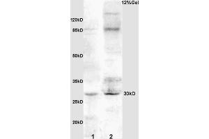 L1 rat kidney lysates L2 rat brain lysates probed with Anti IGFBP3 Polyclonal Antibody, Unconjugated (ABIN686497) at 1:200 overnight at 4 °C. (IGFBP3 antibody  (AA 186-292))