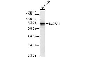 Western blot analysis of extracts of Rat liver, using IL22R antibody (0941) at 1:500 dilution. (IL22 Receptor alpha 1 antibody)