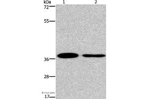 Western blot analysis of 293T and A549 cell, using SNAI1 Polyclonal Antibody at dilution of 1:200 (SNAIL antibody)