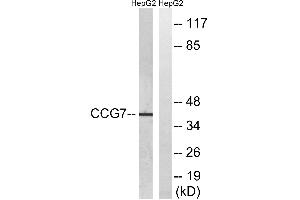 Western blot analysis of extracts from HepG2 cells, using CACNG7 antibody.
