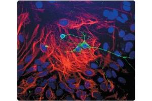 Dissociated cell culture of a neonatal Mouse brain showing Beta-Tubulin III (green staining) of neurons. (TUBB3 antibody)
