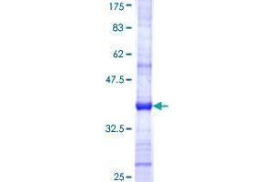 CCR4-NOT Transcription Complex, Subunit 1 (CNOT1) (AA 2278-2375) protein (GST tag)