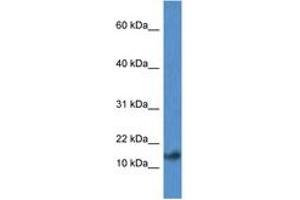 Image no. 1 for anti-Presenilin Enhancer 2 Homolog (PSENEN) (AA 20-69) antibody (ABIN6747253) (PEN2 antibody  (AA 20-69))