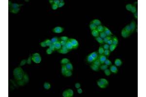 Immunofluorescence staining of PC-3 cells with ABIN7145507 at 1:100, counter-stained with DAPI. (Hexosaminidase A antibody  (AA 89-529))