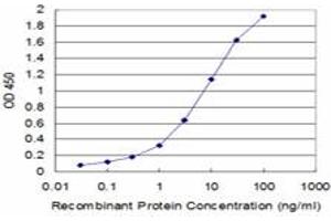Detection limit for recombinant GST tagged UROD is approximately 0. (UROD antibody  (AA 268-367))