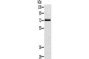Western Blotting (WB) image for anti-Synovial Sarcoma, X Breakpoint 2 Interacting Protein (SSX2IP) antibody (ABIN2424211) (SSX2IP antibody)