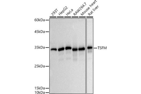TSFM anticorps