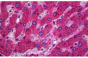 Human Liver: Formalin-Fixed, Paraffin-Embedded (FFPE) (Complement C3c antibody)