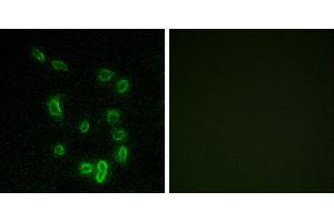 P-peptide - +Immunofluorescence analysis of HepG2 cells, using DARPP-32 (Phospho-Thr34) antibody. (DARPP32 antibody  (pThr34))