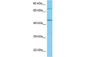 Host:  Rabbit  Target Name:  GNPAT  Sample Type:  Jurkat Whole Cell lysates  Antibody Dilution:  1. (GNPAT antibody  (N-Term))
