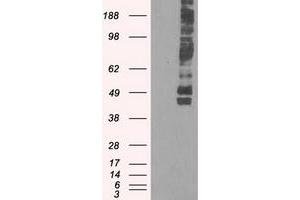 Image no. 4 for anti-Solute Carrier Family 2 (Facilitated Glucose/fructose Transporter), Member 5 (SLC2A5) antibody (ABIN1498478) (SLC2A5 antibody)