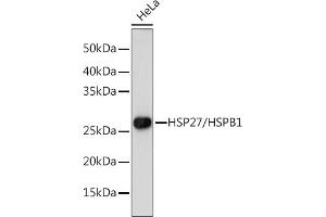Western blot analysis of extracts of HeLa cells, using HSP27/HSP27/HSPB1 antibody (ABIN7267568) at 1:1000 dilution.