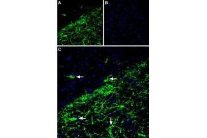 Expression of GIRK2 (Kir3.