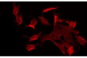 ABIN6275596 staining COLO205 by IF/ICC. (SLC4A8/10 antibody)
