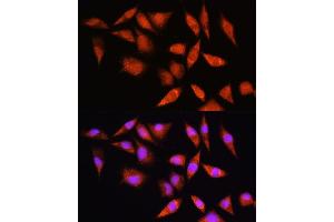 Immunofluorescence analysis of L929 cells using HSP antibody (ABIN6128040, ABIN6142040, ABIN6142041 and ABIN6223893) at dilution of 1:100. (HSPA2 antibody  (AA 400-639))
