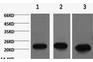 Western Blot analysis of 1) MCF7, 2) Rat kidney, 3) Mouse brain using PRDX1 Monoclonal Antibody at dilution of 1:2000. (Peroxiredoxin 1 antibody)