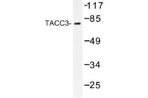 Image no. 1 for anti-Transforming, Acidic Coiled-Coil Containing Protein 3 (TACC3) antibody (ABIN317622) (TACC3 antibody)