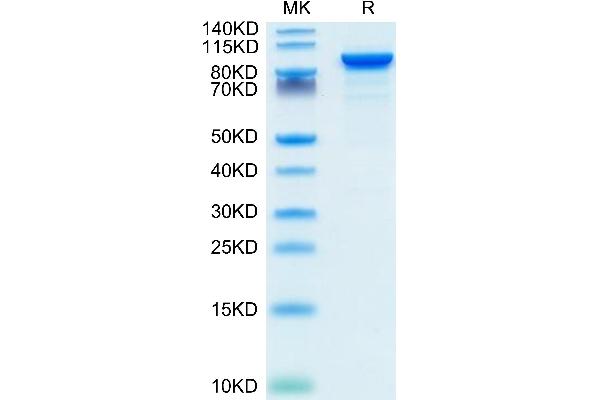 ENPP2 Protein (AA 49-862) (His tag)