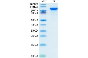 Mouse ENPP-2/Autotaxin on Tris-Bis PAGE under reduced condition. (ENPP2 Protein (AA 49-862) (His tag))