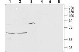 Western blot analysis of rat brain (lanes 1 and 4), mouse brain (lanes 2 and 5) and human SH-SY5Y (lanes 3 and 6) lysates: - 1-3. (MCHR1 antibody  (Extracellular, N-Term))