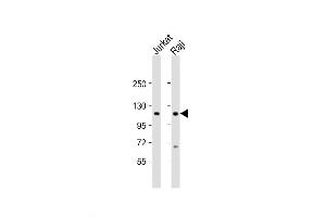 Western Blot at 1:2000 dilution Lane 1: Jurkat whole cell lysate Lane 2: Raji whole cell lysate Lysates/proteins at 20 ug per lane. (WHSC1 antibody  (C-Term))