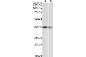 ABIN5539476 (2µg/ml) staining of Mouse (A) and Rat (B) Brain lysates (35µg protein in RIPA buffer).