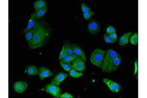 Immunofluorescent analysis of HepG2 cells using ABIN7160861 at dilution of 1:100 and Alexa Fluor 488-congugated AffiniPure Goat Anti-Rabbit IgG(H+L) (SIRT3 antibody  (AA 20-130))