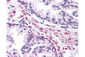 Anti-LEF1 antibody IHC of human prostate. (LEF1 antibody  (AA 51-100))