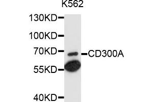 Western blot analysis of extracts of K-562 cells, using CD300A antibody (ABIN6003714) at 1/1000 dilution. (CD300a antibody)