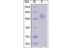 SARS-CoV-2 S1 protein, His Tag on  under reducing (R) condition. (SARS-CoV-2 Spike S1 Protein (P.1 - gamma) (His tag))