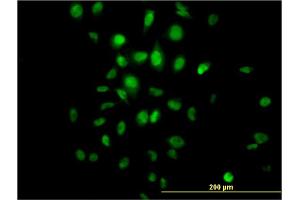 Immunofluorescence of monoclonal antibody to HDAC3 on HeLa cell. (HDAC3 antibody  (AA 319-428))