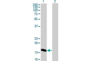 Western Blot analysis of BARX1 expression in transfected 293T cell line by BARX1 monoclonal antibody (M01A), clone 1E7.