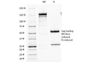 SDS-PAGE Analysis of Purified, BSA-Free Parathyroid Hormone Antibody (clone PTH/1173). (PTH antibody  (AA 32-115))