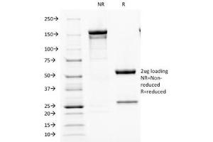 SDS-PAGE Analysis of Purified, BSA-Free Parathyroid Hormone Antibody (clone PTH/1173).