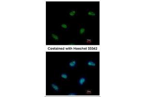 ICC/IF Image Immunofluorescence analysis of paraformaldehyde-fixed HeLa, using Rad9, antibody at 1:500 dilution. (RAD9A antibody  (Center))