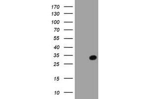 HEK293T cells were transfected with the pCMV6-ENTRY control (Left lane) or pCMV6-ENTRY SDS (Right lane) cDNA for 48 hrs and lysed. (serine Dehydratase antibody)