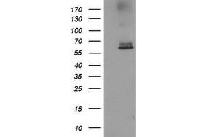 HEK293T cells were transfected with the pCMV6-ENTRY control (Left lane) or pCMV6-ENTRY ACOT12 (Right lane) cDNA for 48 hrs and lysed. (ACOT12 antibody)