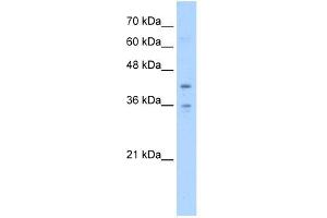 TMEM104 antibody used at 5 ug/ml to detect target protein. (TMEM104 antibody  (Middle Region))