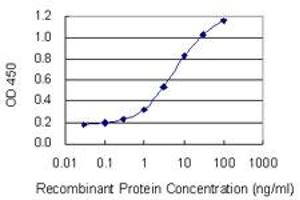 Detection limit for recombinant GST tagged SIX2 is 0. (SIX2 antibody  (AA 1-291))