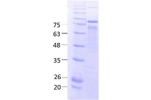 Delta-Like 1 Homolog (DLK1) (AA 24 -383), fraction 12 (DLK1 Protein (AA 24-383) (rho-1D4 tag,MBP tag))