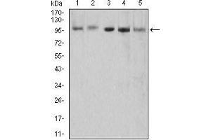 Western blot analysis using XRN2 mouse mAb against HEK293 (1), NTERA-2 (2), LNcap (3), HepG2 (4), and PC-3 (5) cell lysate. (XRN2 antibody  (AA 398-547))