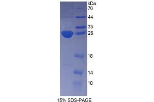SDS-PAGE analysis of Mouse KATNA1 Protein. (KATNA1 Protein)