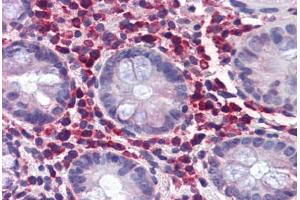 Human Colon (formalin-fixed, paraffin-embedded) stained with TRIM21 antibody ABIN337310 at 5 ug/ml followed by biotinylated anti-goat IgG secondary antibody ABIN481715, alkaline phosphatase-streptavidin and chromogen. (TRIM21 antibody  (AA 386-398))